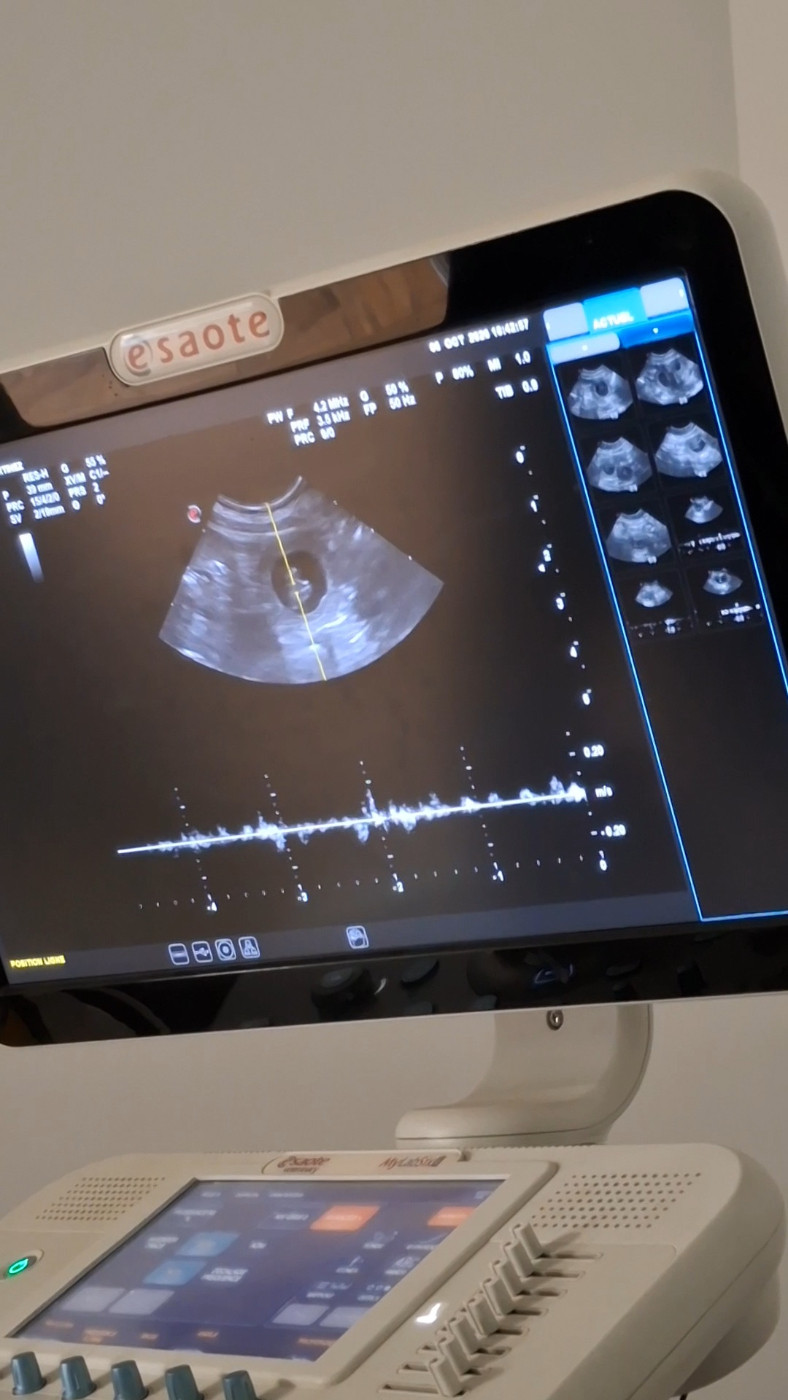 🐾 Des nouvelles de Rhéïa : Confirmation de la gestation.